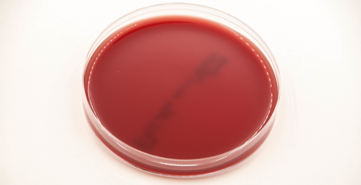 AGAR DE SANGRE CON VITAMINA K AS-111